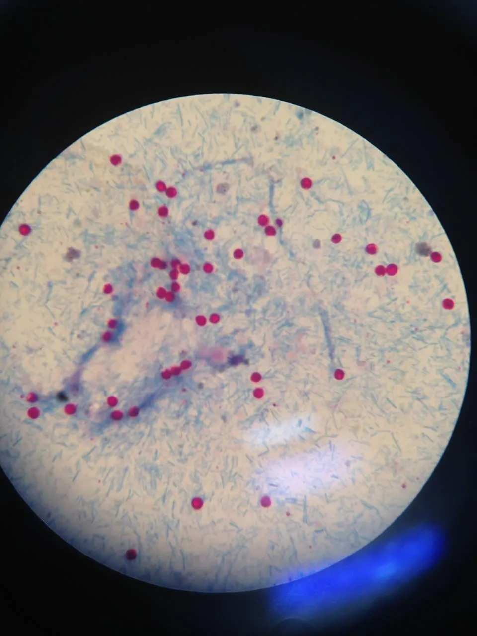Lâmina corada vista ao microscópio, com oocistos de Cryptosporidium em vermelho sobre fundo azul